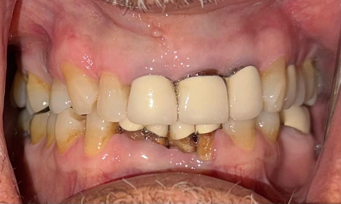 Patient smile before full-mouth treatment at Wellness Dental Tucson