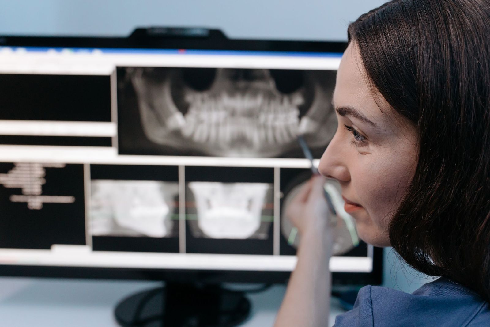 Clinician studying a panoramic dental X-ray on a monitor